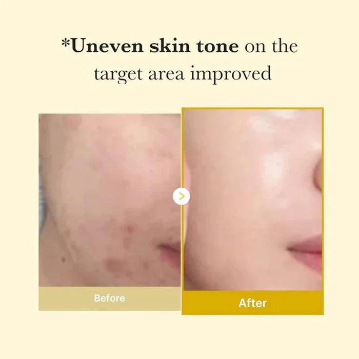 Kojic Acid Turmeric Overnight Wrapping Mask |Buy 1 Get 1 Free|