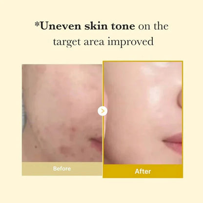 Kojic Acid Turmeric Overnight Wrapping Mask |Buy 1 Get 1 Free|